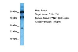 CC2D2B Antibody, Novus Biologicals 100 &mu;L | Buy Online | Novus Biologicals | Fisher Scientific